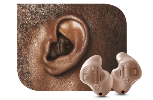 tipo de audifono ITE para sordera Intraauricular In The Ear masaudio